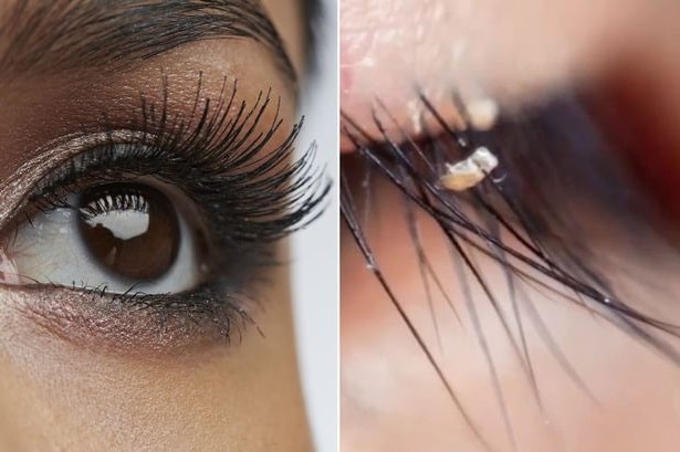 extension de cils poux