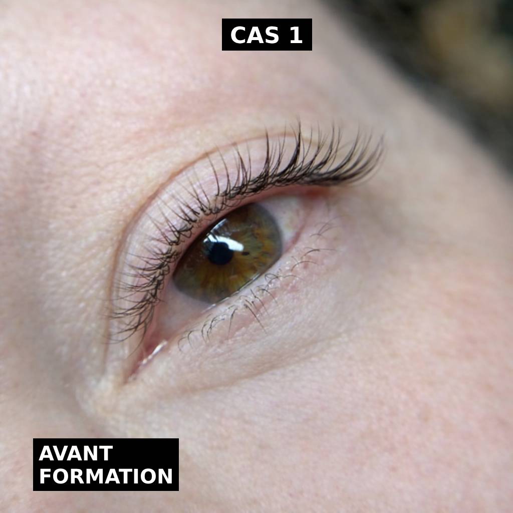 Cas 1 avant formation Cas 1 avant formation