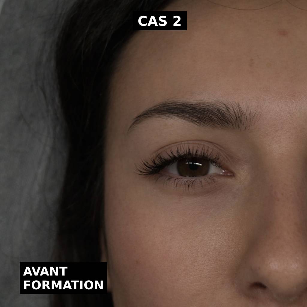 Cas 2 avant formation Cas 2 avant formation