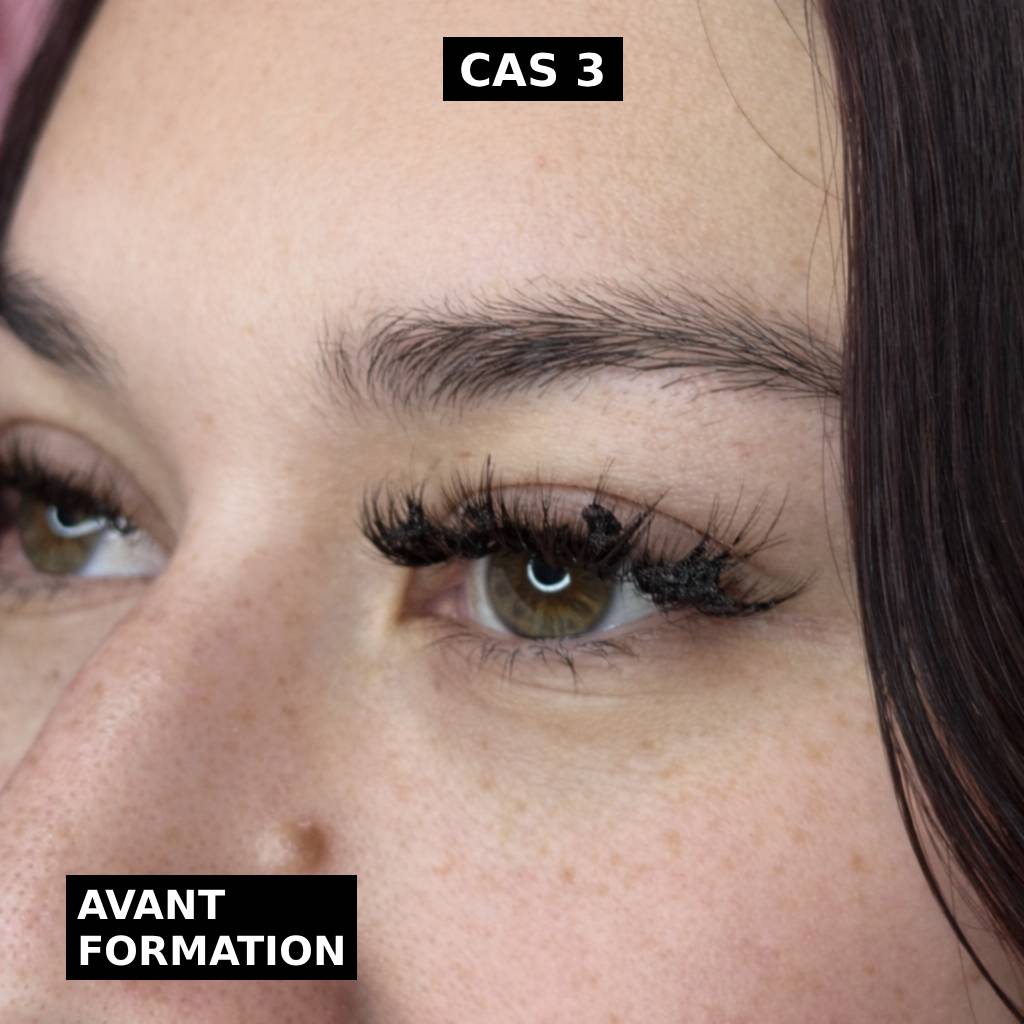 Cas 3 avant formation Cas 3 avant formation